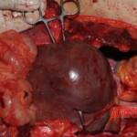 Stabbed woman in morgue