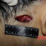 Stabbed woman in morgue