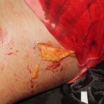 Girl stabbed to death