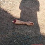 Butchered Indonesian wife