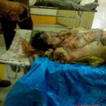 Dismembered female body