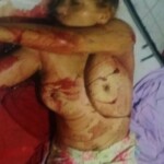 Stabbed and raped woman