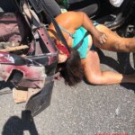 Woman scalped by seat belt