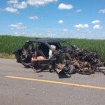 Woman scalped by seat belt