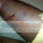 Shot dead brazilian woman