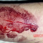 Wrist cut by blunt object