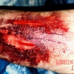 Wrist cut by blunt object