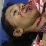 Slashed young girl