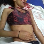 Slashed young girl