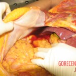 Detailed autopsy of Chinese woman