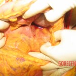 Detailed autopsy of Chinese woman