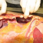 Detailed autopsy of Chinese woman