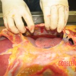 Detailed autopsy of Chinese woman