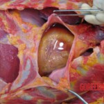 Detailed autopsy of Chinese woman