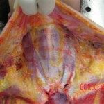 Detailed autopsy of Chinese woman