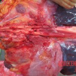 Detailed autopsy of Chinese woman