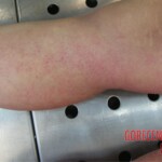 Detailed autopsy of Chinese woman