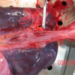 Detailed autopsy of Chinese woman