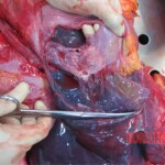 Detailed autopsy of Chinese woman