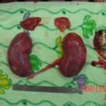 Detailed autopsy of Chinese woman