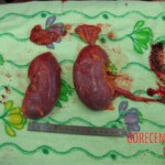 Detailed autopsy of Chinese woman