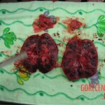 Detailed autopsy of Chinese woman