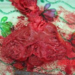 Detailed autopsy of Chinese woman