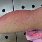 Detailed autopsy of Chinese woman