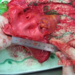 Detailed autopsy of Chinese woman