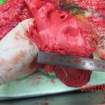 Detailed autopsy of Chinese woman