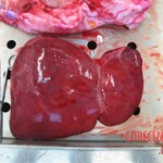 Detailed autopsy of Chinese woman