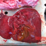 Detailed autopsy of Chinese woman