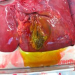 Detailed autopsy of Chinese woman