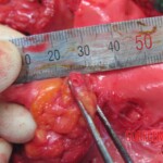 Detailed autopsy of Chinese woman