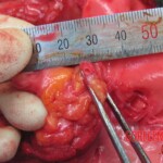 Detailed autopsy of Chinese woman