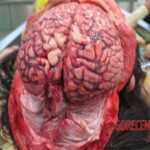 Detailed autopsy of Chinese woman