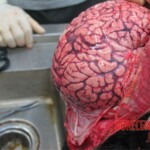 Detailed autopsy of Chinese woman