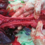 Detailed autopsy of Chinese woman