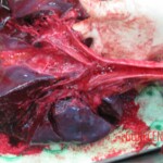 Detailed autopsy of Chinese woman