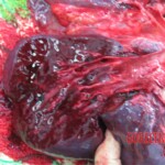 Detailed autopsy of Chinese woman