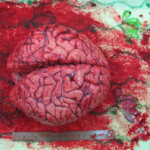 Detailed autopsy of Chinese woman