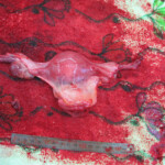 Detailed autopsy of Chinese woman