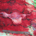 Detailed autopsy of Chinese woman