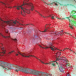 Detailed autopsy of Chinese woman