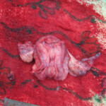 Detailed autopsy of Chinese woman