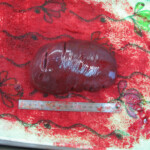 Detailed autopsy of Chinese woman