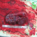 Detailed autopsy of Chinese woman