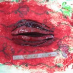 Detailed autopsy of Chinese woman