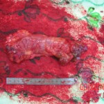 Detailed autopsy of Chinese woman