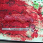 Detailed autopsy of Chinese woman